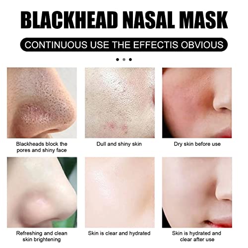 Маска за премахване на черни точки с ивици за още -Растения за носа С ивици за още Естественото Почистване на Лицето си за Дълбоко Почистване