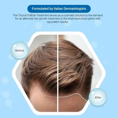 Лосион за коса Tricovit Forte - Серум за растеж на косата С андрогенами и ДХТ блокери За Изтъняване на косата - Допринася