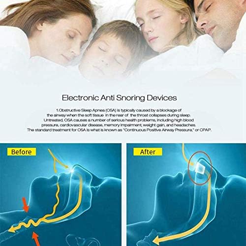 Устройство против хъркане 3 в 1, Електрическо средство от Хъркането на мъжете и жените, Удължител на носа, мъничета за носните отвори