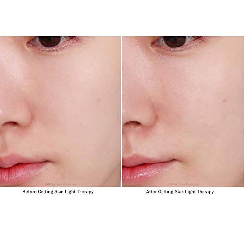 Домашен козметичен уред MAKEON Skin Light Therapy II, за да се придаде на кожата еластичност, MO-ST002