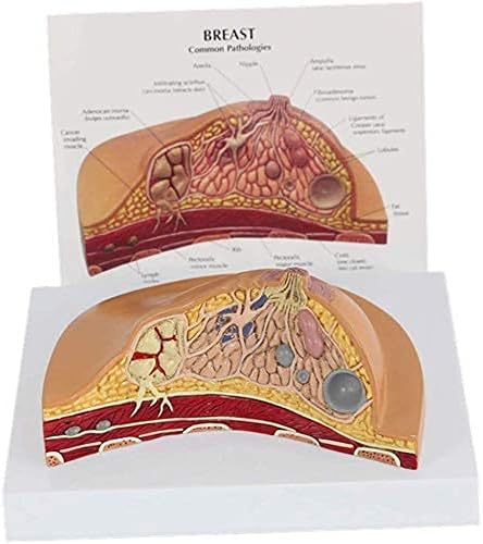 Образователна модел, 11 Анатомическая модел на женски гърди, Анатомическая модел на изкуствен патологичния участък на млечната жлеза - за комуникация между лекар и